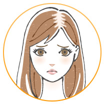 女子男性型脱毛症