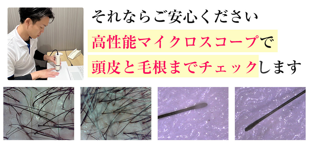 【発毛】それならご安心ください高性能マイクロスコープで頭皮と毛根までチェックします
