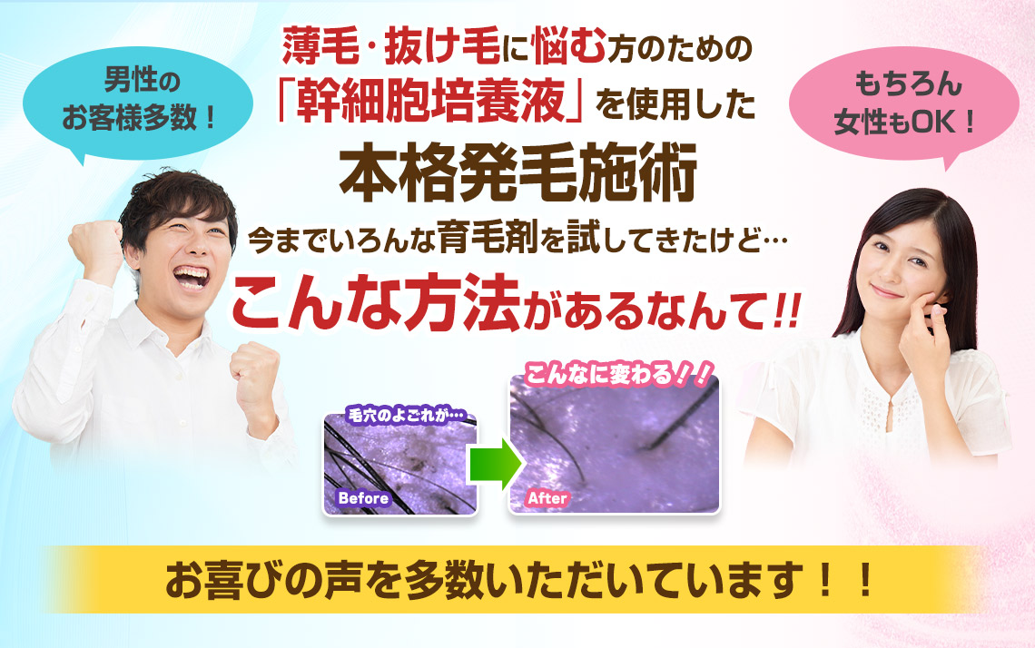 本格発毛施術