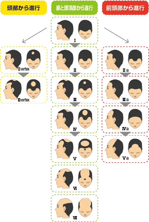【発毛】頭皮チェック